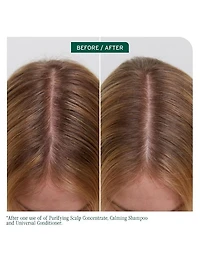 Après-shampoing universel Biolage Scalp Sync - 1L