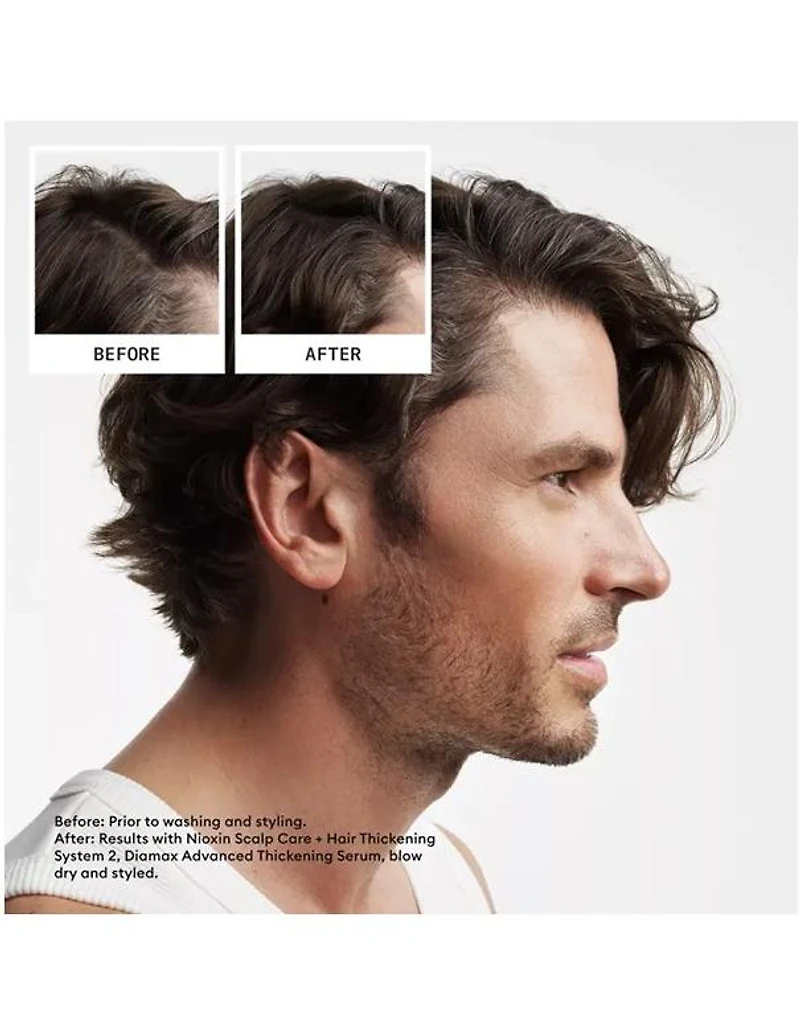 Nioxin System 2 Scalp & Hair Shampoo - 300ml