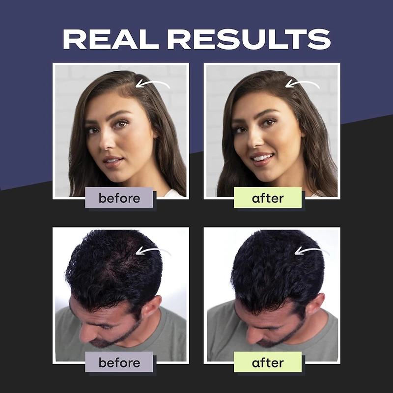 TOPPIK Hair Building Fibers (Black