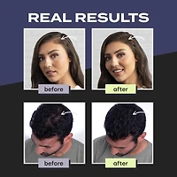 TOPPIK Hair Building Fibers (Black