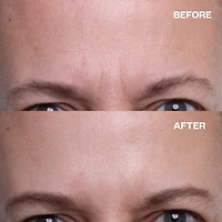 Wrinkles Schminkles Forehead Patches