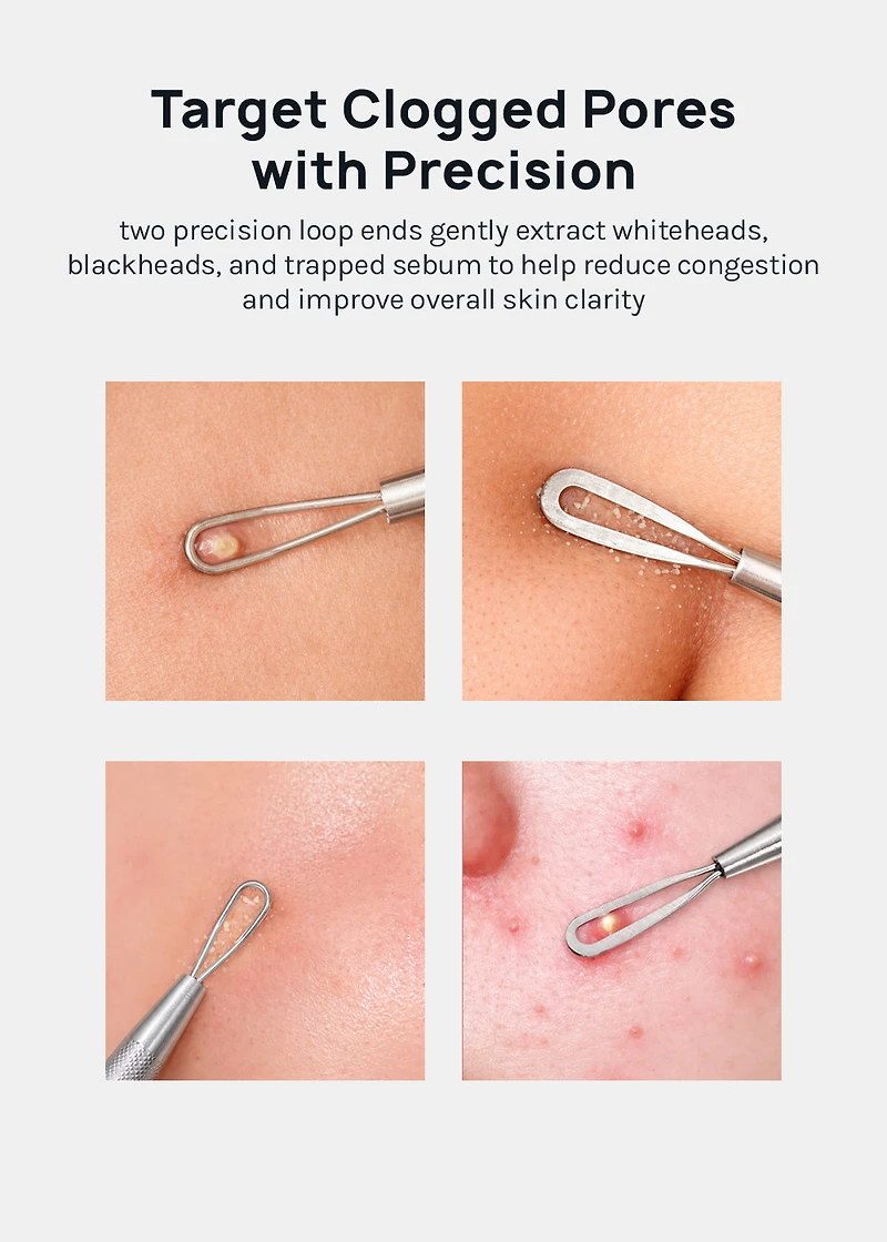 AOA Studio Blackhead Remover Tool