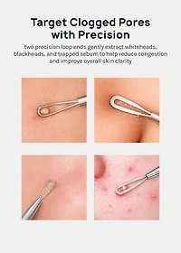 AOA Studio Blackhead Remover Tool
