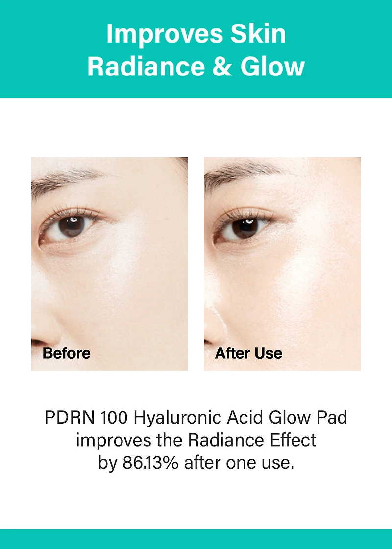 Anua PDRN 100 Hyaluronic Acid Glow Pad (60 Pads)