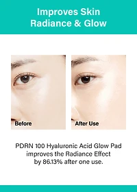Anua PDRN 100 Hyaluronic Acid Glow Pad (60 Pads)