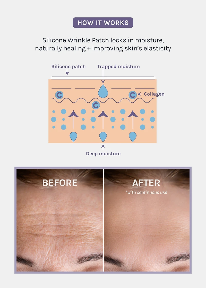 AOA Skin Wrinkle Smoothing Patch – Chest