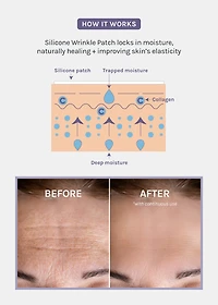 AOA Skin Wrinkle Smoothing Patch – Chest