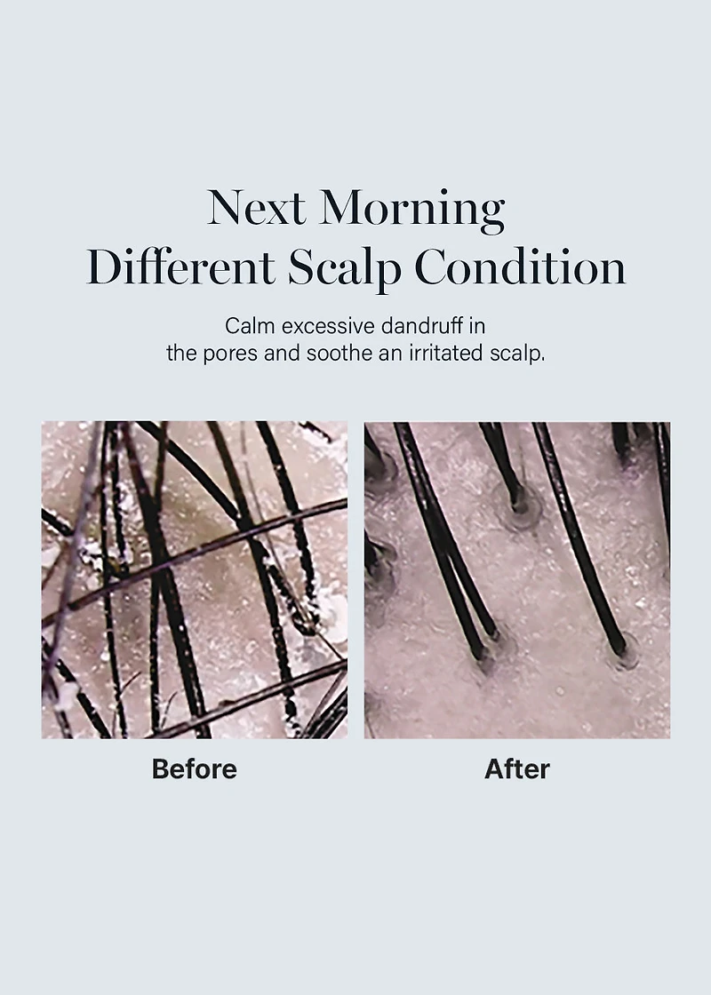 GROWUS Damage Therapy Scalp Scaling Ampoule 50ml