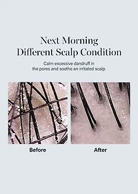 GROWUS Damage Therapy Scalp Scaling Ampoule 50ml