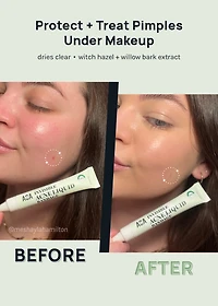 AOA Skin Invisible Acne Liquid Bandage