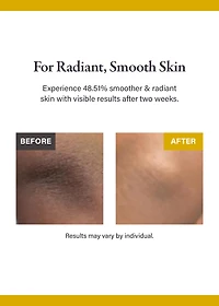 medicube Kojic Acid Turmeric Body Peel Shot 280ml