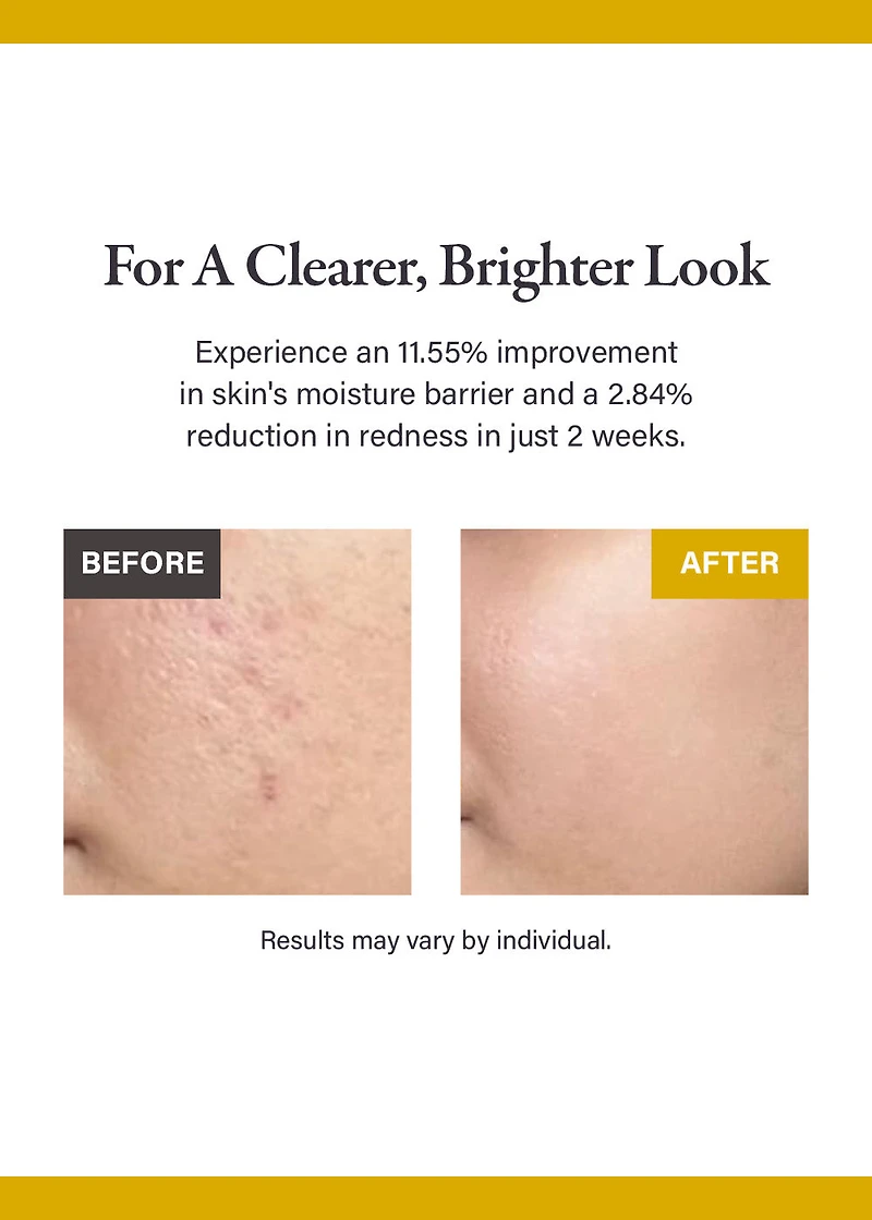 medicube Kojic Acid Turmeric Niacinamide Serum 30ml