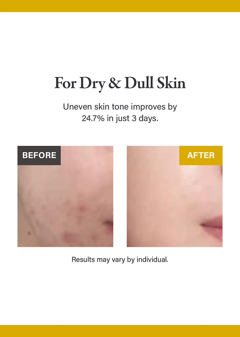 medicube Kojic Acid Turmeric Night Wrapping Mask 75ml