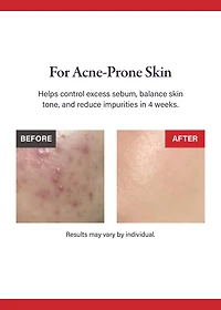 medicube Red Succinic Acid Peeling Pad (70 Pads)