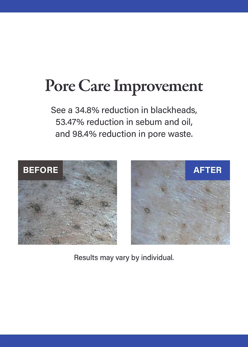 medicube Zero Pore Blackhead Mud Mask 100g