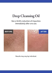 medicube Zero Pore Blackhead Deep Cleansing Oil 205ml