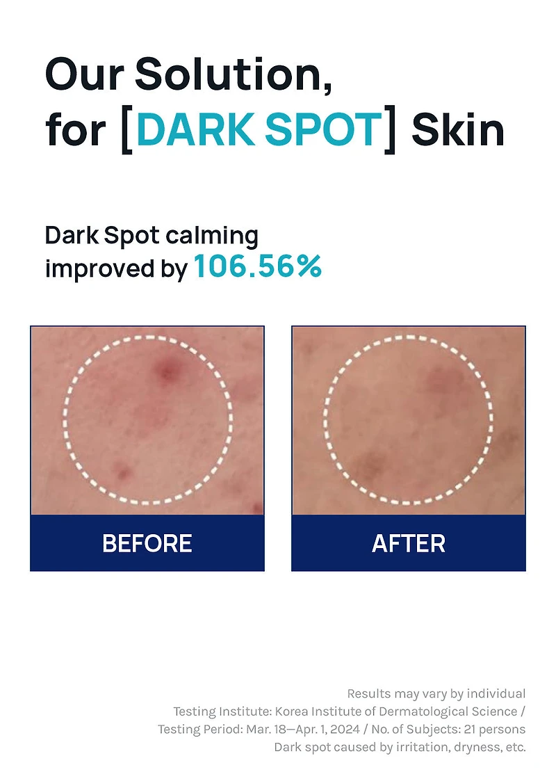 MEDIHEAL Madecassoside Blemish Repair Serum 40ml