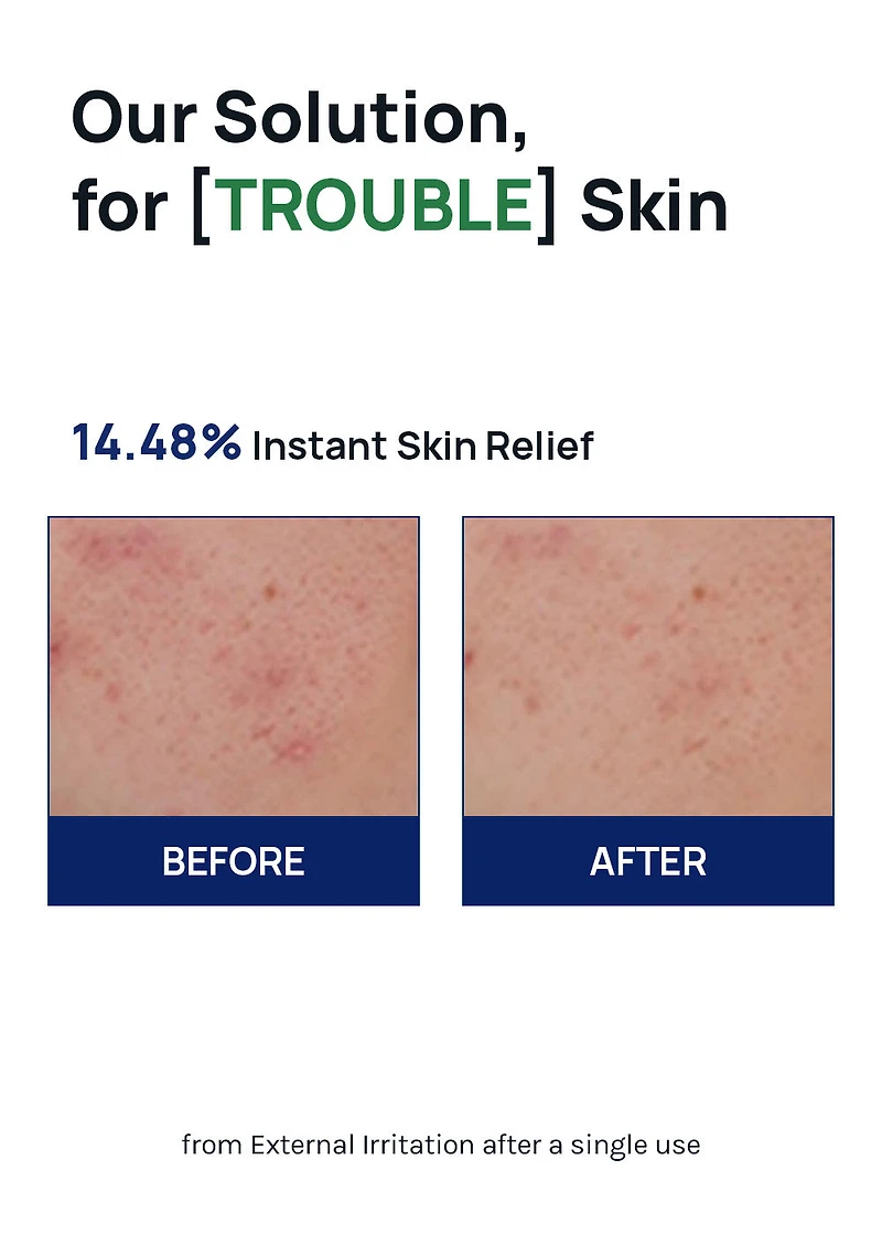 MEDIHEAL Teatree Calming Hydra Serum 40ml
