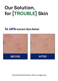 MEDIHEAL Teatree Calming Hydra Serum 40ml