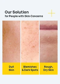 MEDIHEAL Vitamin C Brightening Serum 40ml