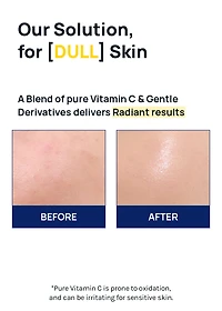 MEDIHEAL Vitamin C Brightening Serum 40ml