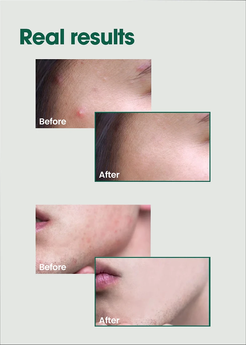 SOME BY MI AHA.BHA.PHA 30 Days Miracle Serum 50ml