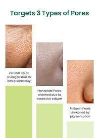 Sungboon Editor Green Tomato Pore Lifting Ampoule Toner 350ml