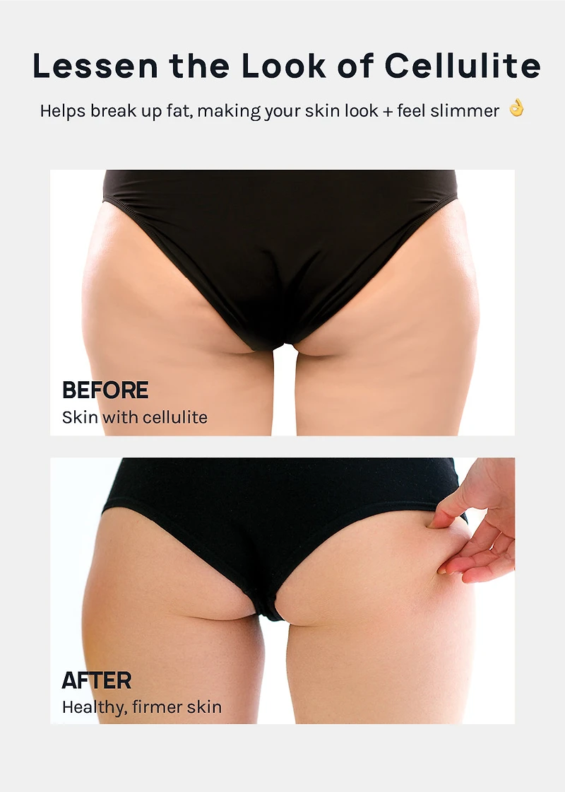 A+ Cellulite Massage Roller