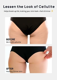 A+ Cellulite Massage Roller