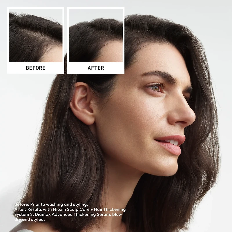 Copy of NIOXIN - SYSTÈME | 1 Cheveux Naturels