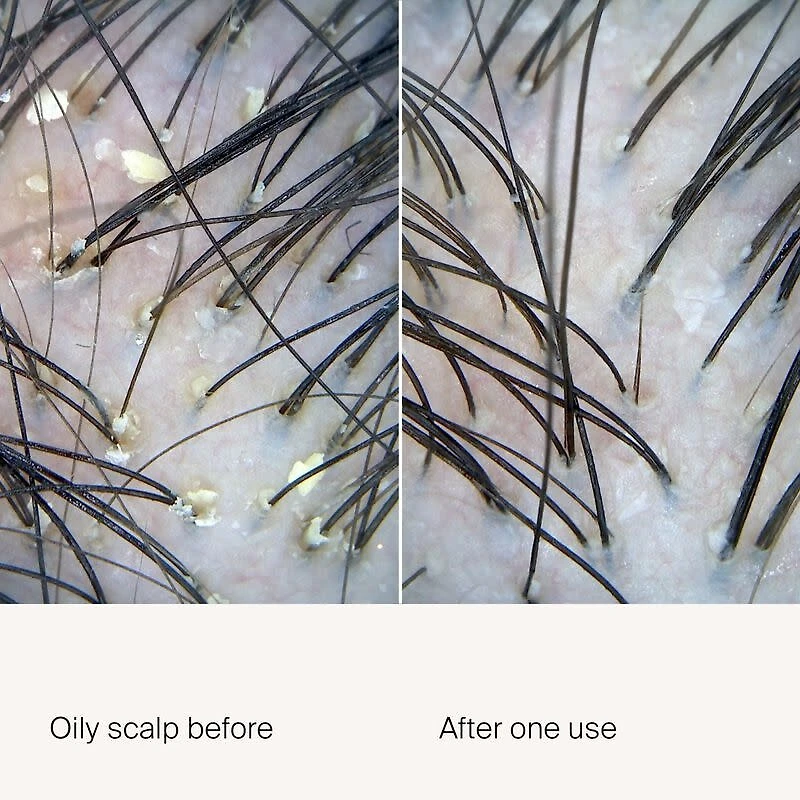 Scalp Care | Exfoliator 100ml (3.4 oz)