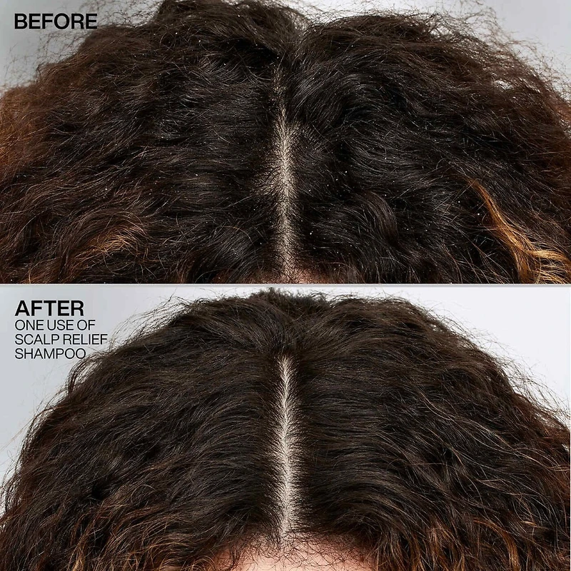 Scalp Relief | Shampooing Antipelliculaire 250 ml