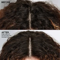 Scalp Relief | Shampooing Antipelliculaire 250 ml