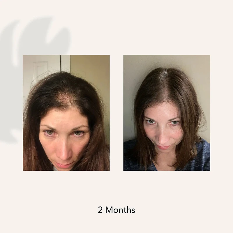 Recover | Women | Thicker Fuller Hair | Travel Size Duo 80ml (2.7 oz)