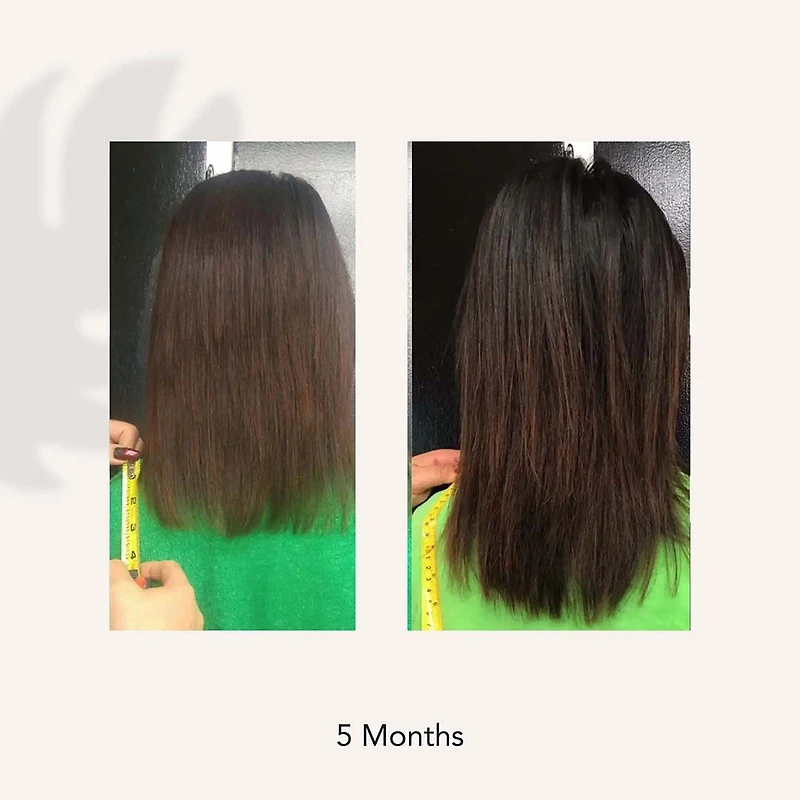 Renew | Healing Shampoo Treatment 215ml (7 oz)