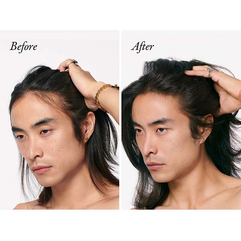 Serene Scalp | Densifying Treatment Spray (175ml/5.9oz)