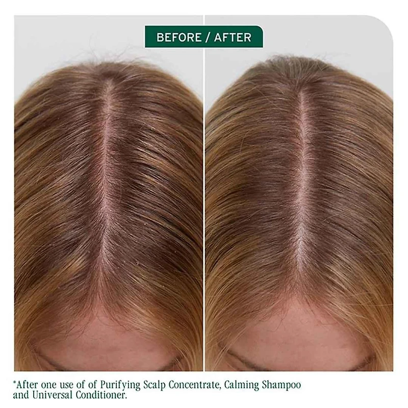 Biolage | Scalp Sync | Purifying Scalp Concentrate (200 ml / 6.8 oz) – Pre-Shampoo Detox for Scalp Balance and Clarity
