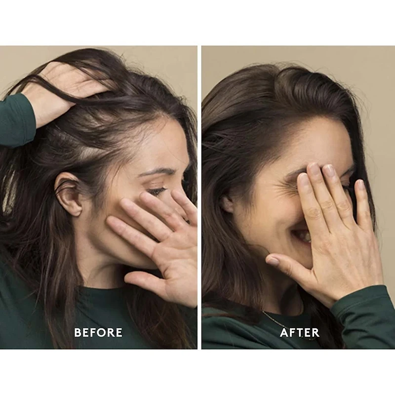 René Furterer | Triphasic — Holiday Gift Set 2025 — Density, Strength & Revitalized Scalp