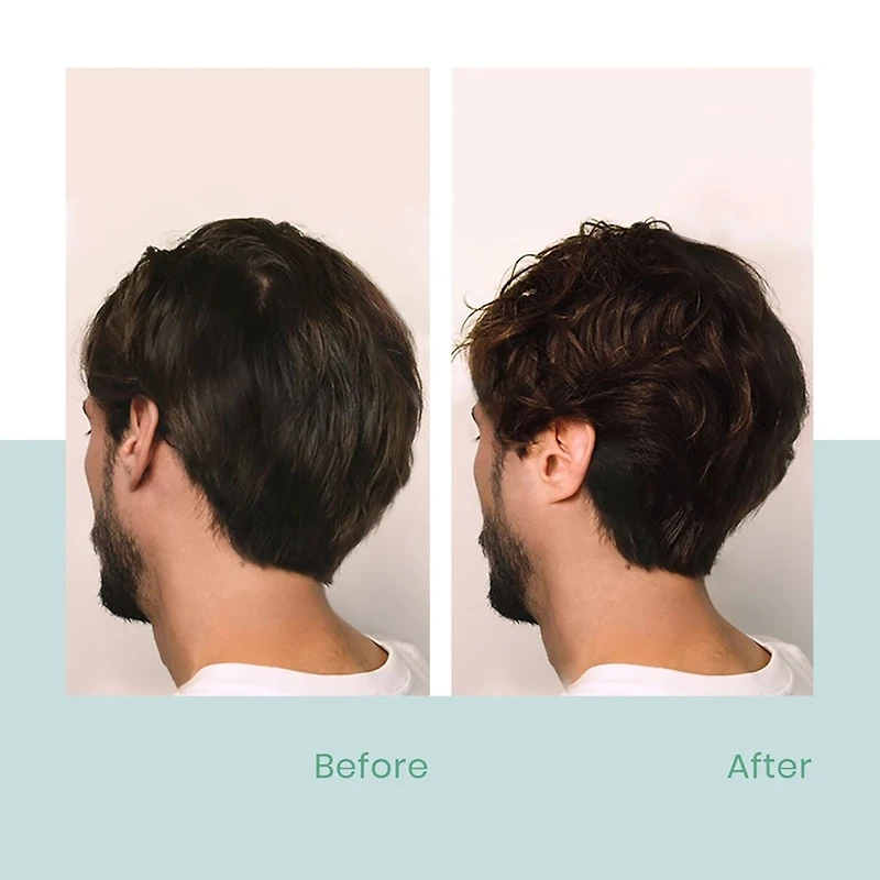 René Furterer | Forticea — Holiday Gift Set 2025 — Energy, Strength & Vitality