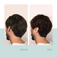 René Furterer | Forticea — Holiday Gift Set 2025 — Energy, Strength & Vitality