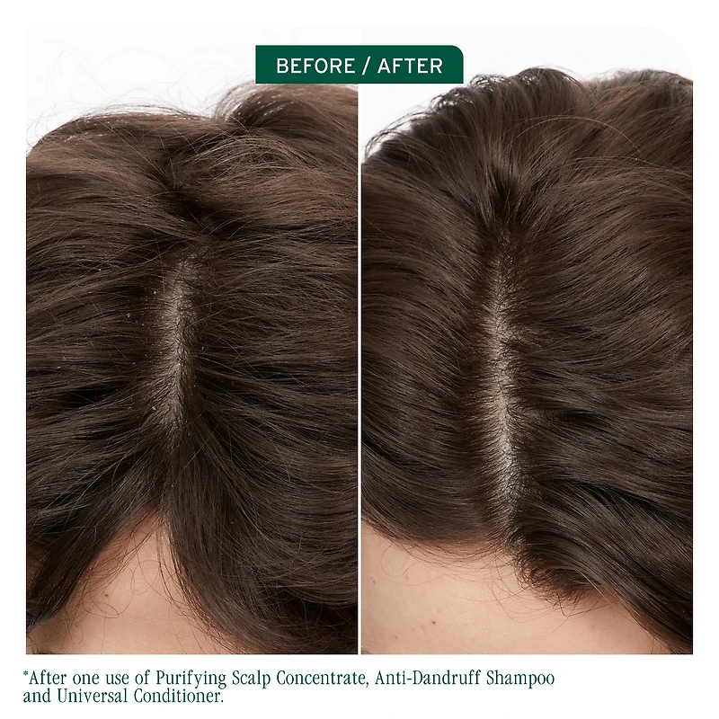 BIOLAGE Scalp Sync Anti-Dandruff Shampoo for Dandruff-Prone