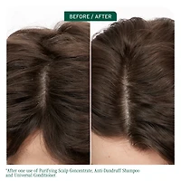 BIOLAGE Scalp Sync Anti-Dandruff Shampoo for Dandruff-Prone
