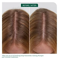 BIOLAGE Scalp Sync Calming Shampoo for Dry or Sensitive