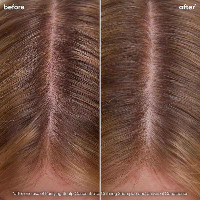 BIOLAGE Scalp Sync Calming Shampoo for Dry or Sensitive Scalp