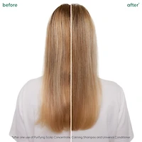BIOLAGE Scalp Sync Calming Shampoo for Dry or Sensitive Scalp