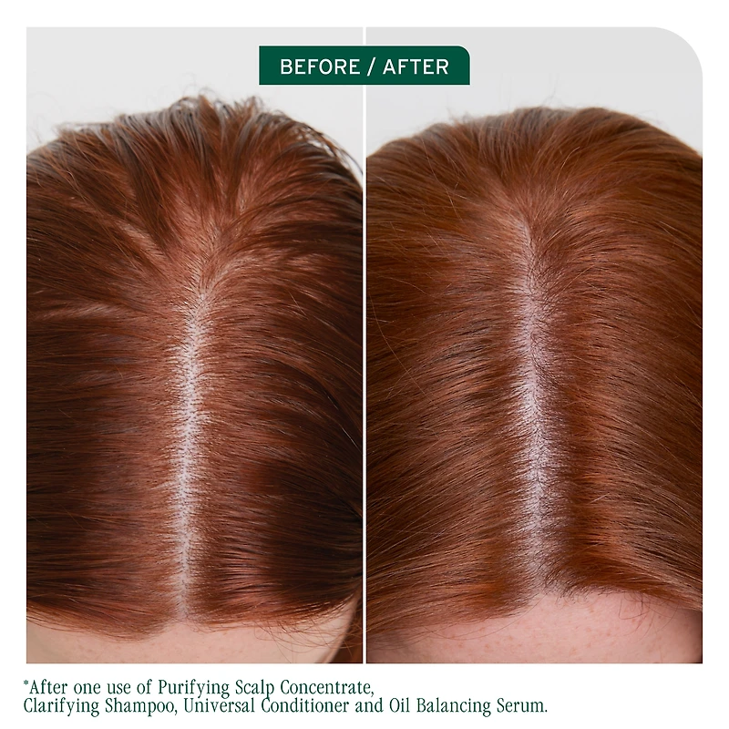 BIOLAGE Scalp Sync Clarifying Shampoo for Oily