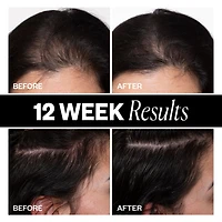 IGK Sponsored Hair Density Scalp Treatment