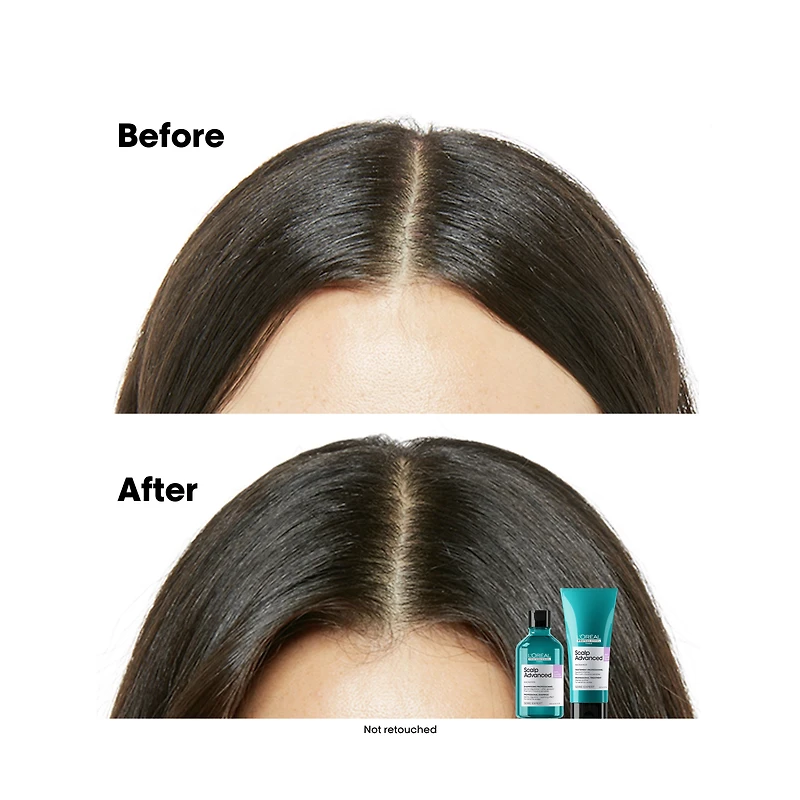 L'OREAL PROFESSIONNEL Serie Expert Scalp Advanced Anti-Discomfort Dermo-Regulator Shampoo Refill