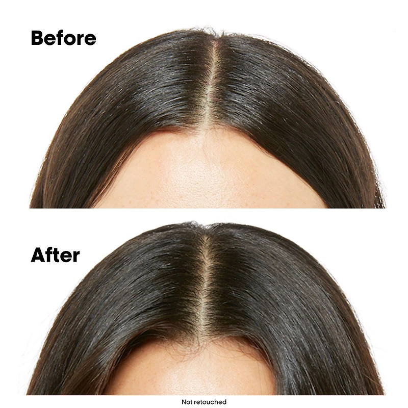 L'OREAL PROFESSIONNEL Scalp Advanced Spring Kit