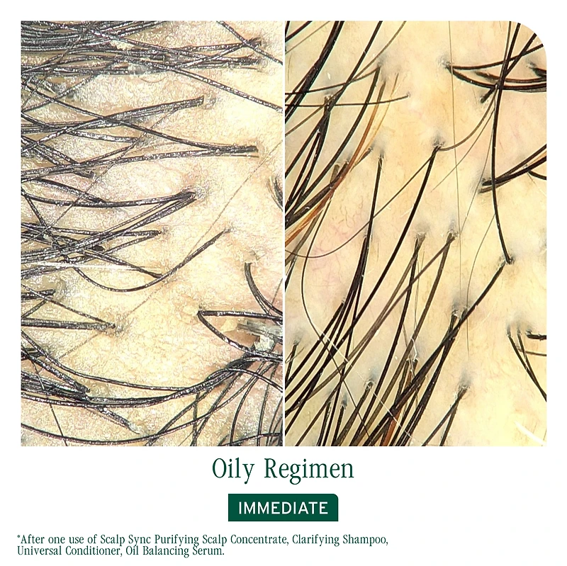 BIOLAGE Scalp Sync Oil Balancing Serum for Oily Scalp